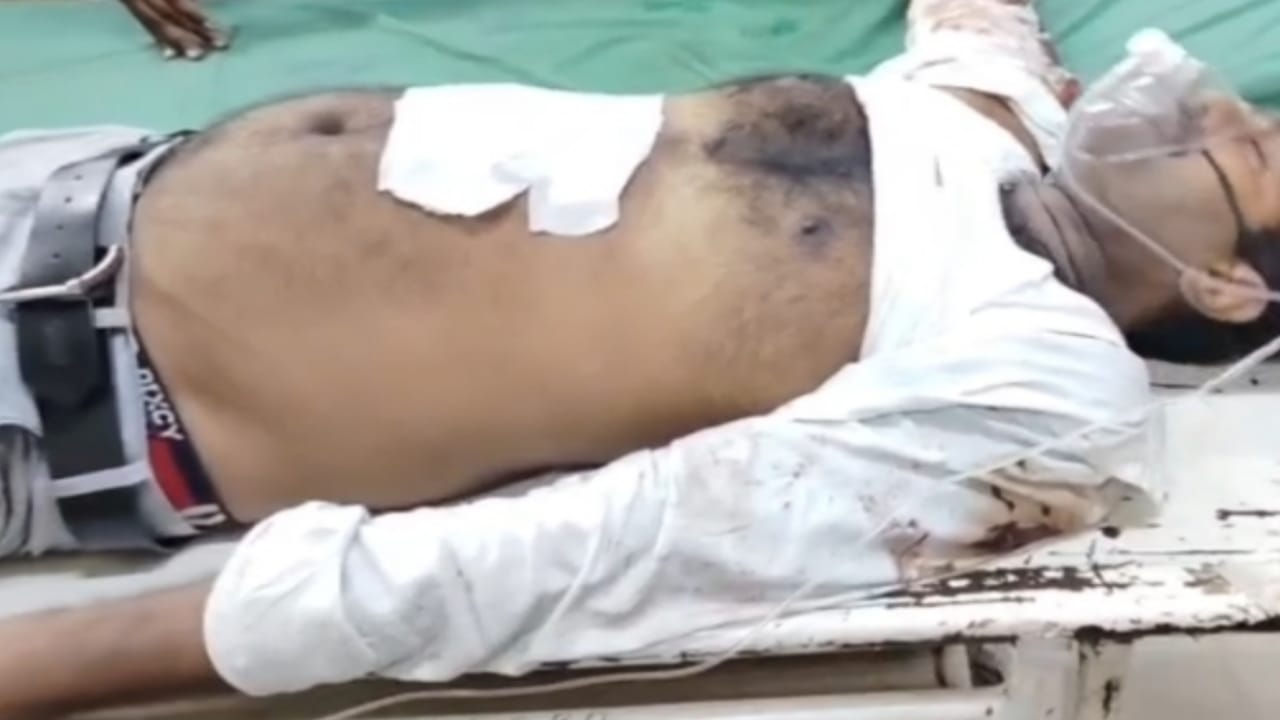 घायल सहज जन सेवा केंद्र संचालक हॉस्पिटल में उपचार के दौरान