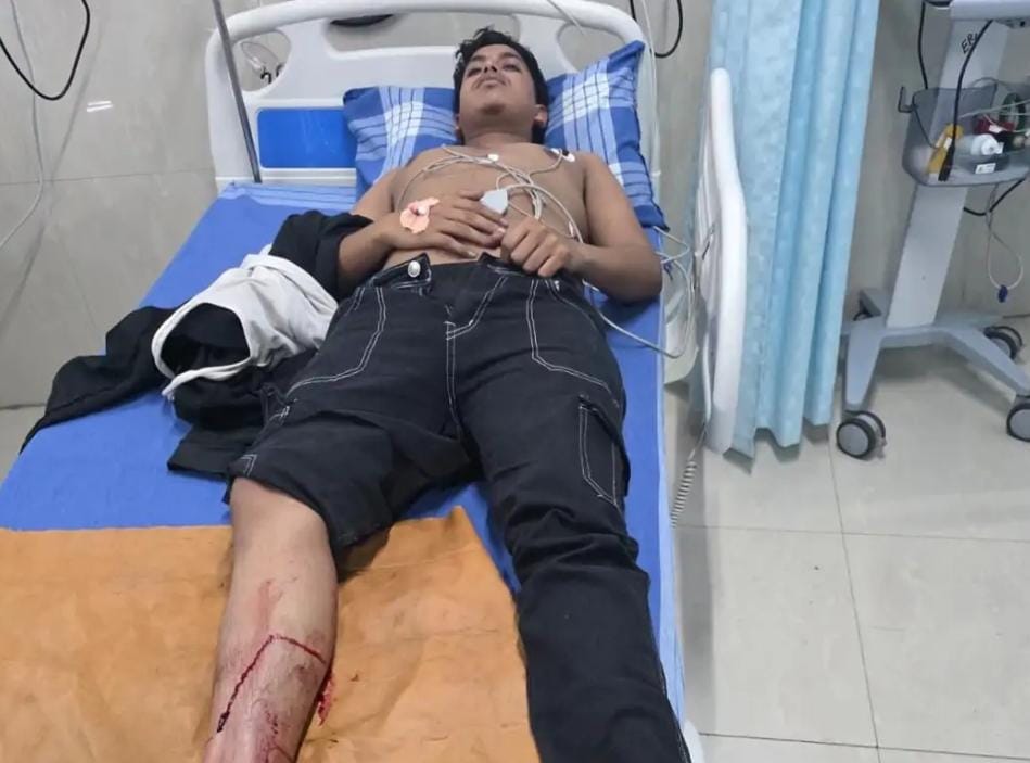 घायल अपराधी घायल अपराधी