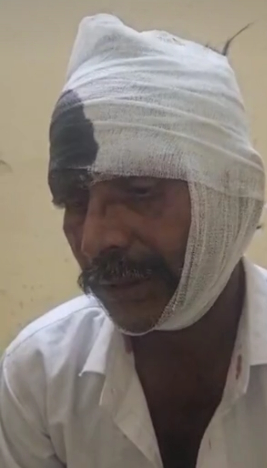 घायल अस्पताल में घायल अस्पताल में